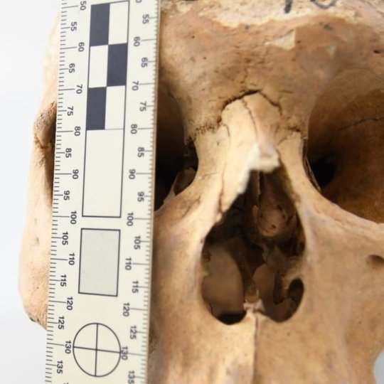 Kasinėjat žmonių palaidojimus Kalnų parke, rasta žmogaus kaukolė. Nuotraukoje šalia jos pastatyta liniuotė, kad matytusi kaukolės mastelis. Kaukolė labai sena, pageltus. Su giliomis akiduobemis ir nosies ertme.
